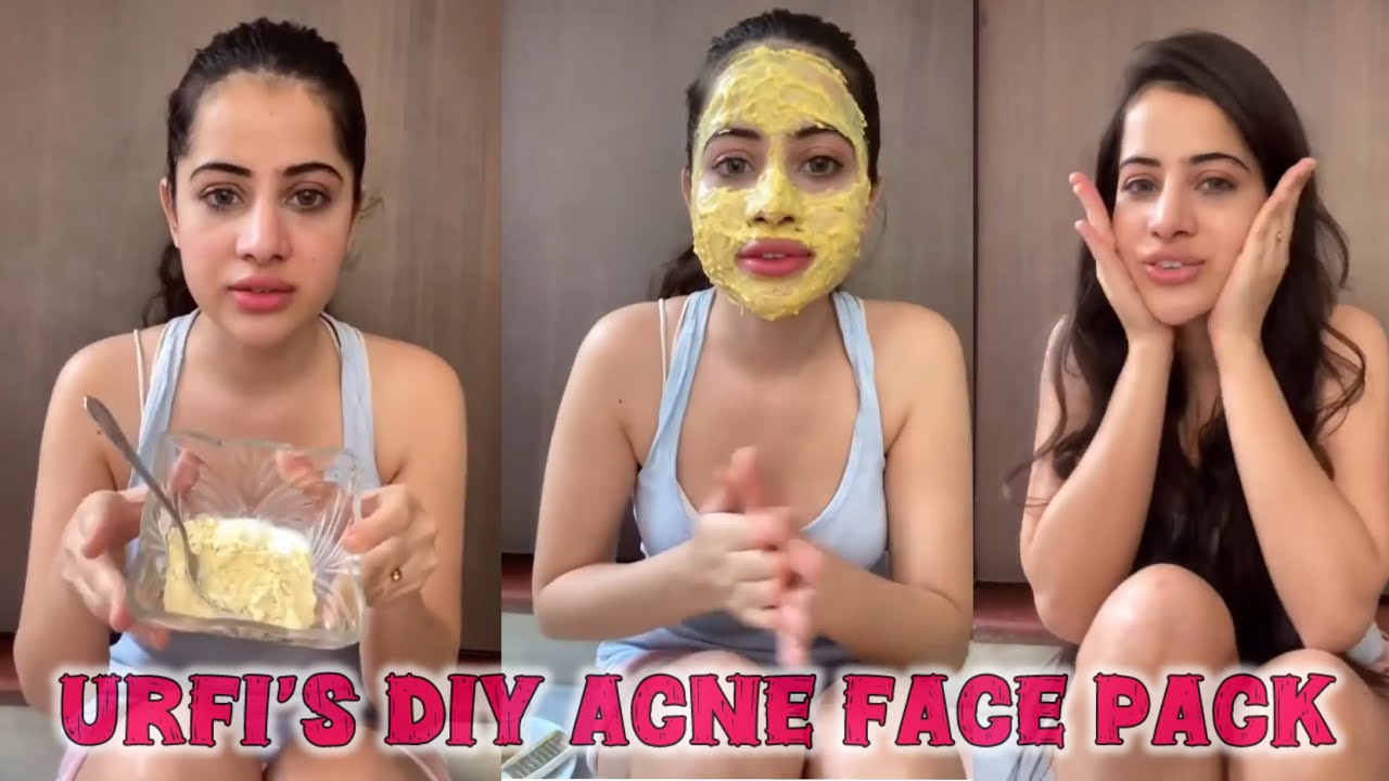Urfi Javed DIY Face Pack For Acne | Viral Face Pack