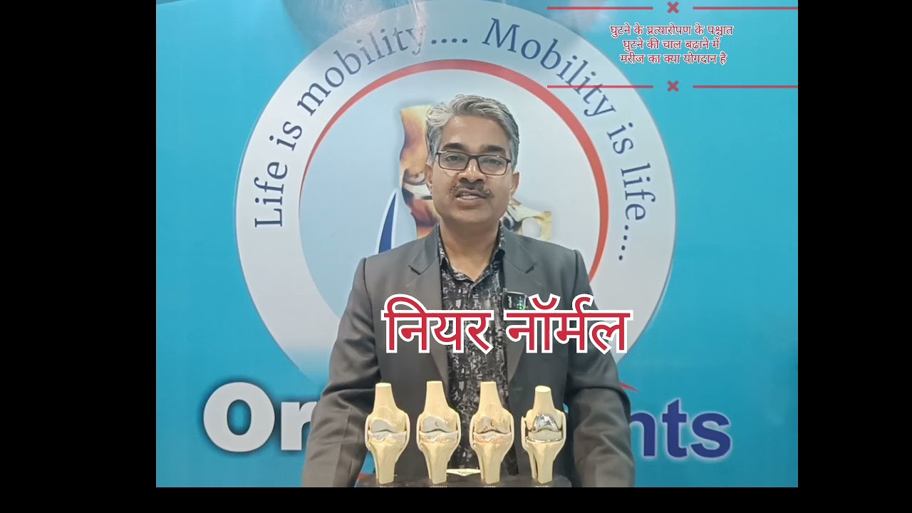 How patients can improve ROM after total knee replacement