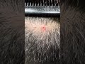 #waxing #ingrownhair #trending #hair #beard #remove #asmr #maazsafder #hairremoval #natural NK.0182