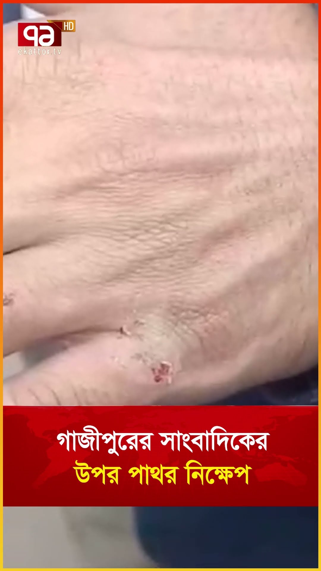 গাজীপুরের সাংবাদিকের ওপর পাথর নিক্ষেপ