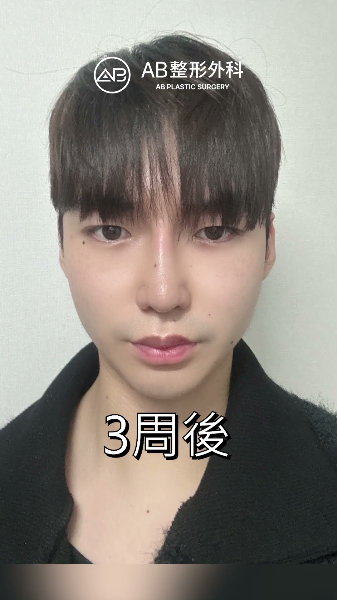 前後差也太大了吧 #shorts