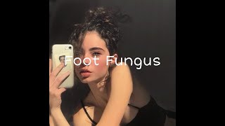 [Vietsub   Lyric] Ski Mask The Slump God - Foot Fungus (remix) | Tiktok Music