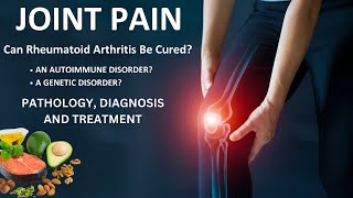 What Is Rheumatoid Arthritis | Pathophysiology | Diet And Treatment | Urdu/Hindi