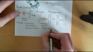 Angiogenesis and Angiotherapy Part 1