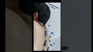 back pain relief cupping therapy /hizama #viral #cupping #hizama #backpain #pain #painrelief #shorts