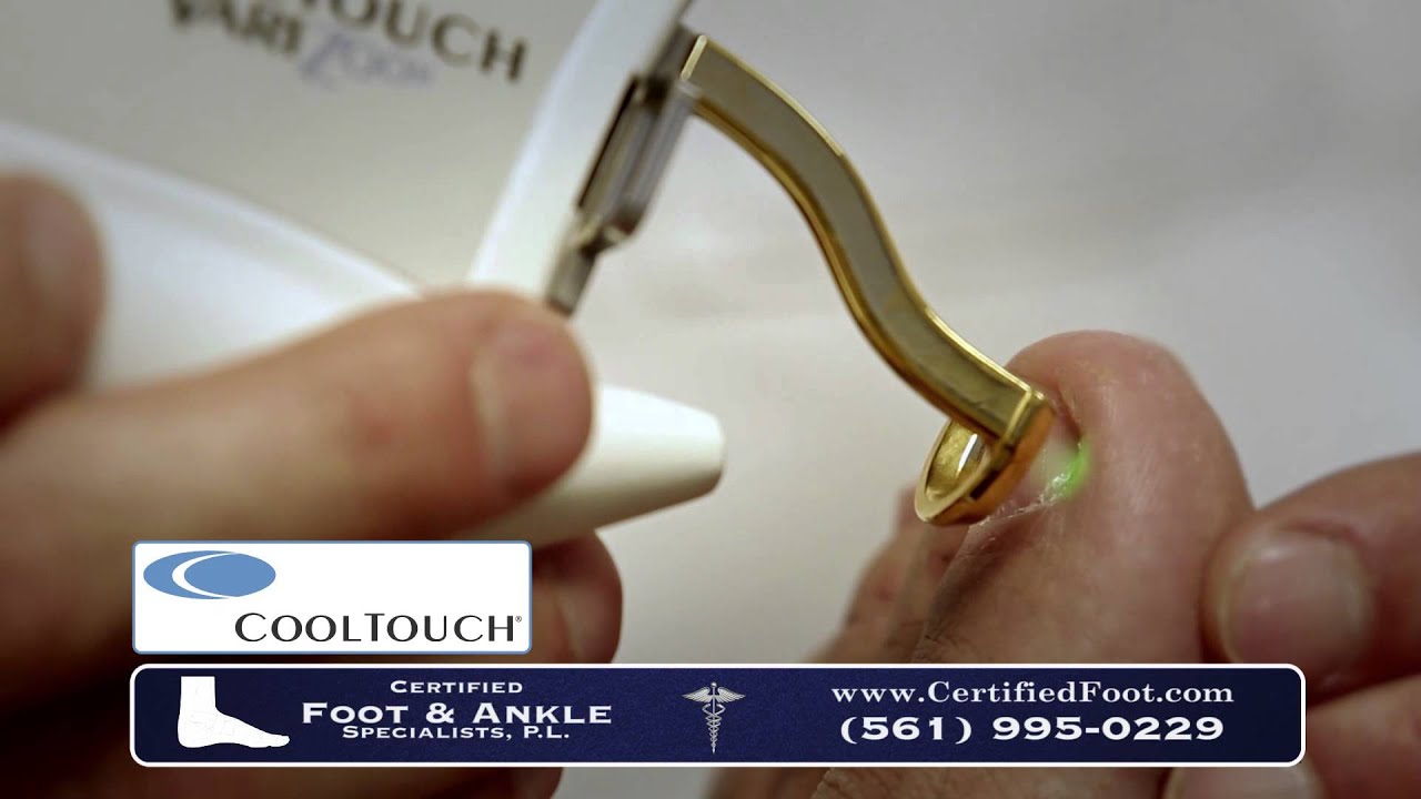 Foot and Ankle Cool Touch Laser | Toe Nail Laser Treatment, Laser Toe nail Treatment | Dr. Kinmon