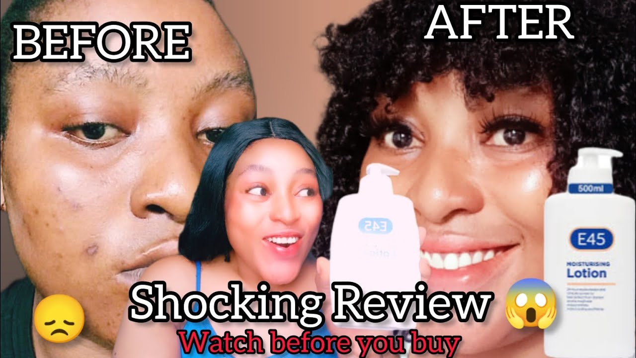 E46 CreamShocking Review 2023 E45 moisturising lotion (review+use)E45