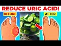 Top 12 POWERFUL Foods To STOP High Uric Acid Naturally