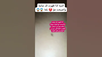 انتبة اذا ظهرت لك شامه واصبحت مو لمة معلومات اهميه 
