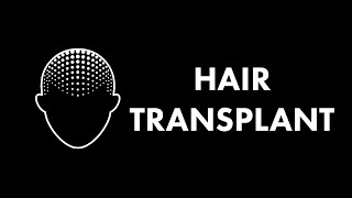 What Is A Hair Transplant?
