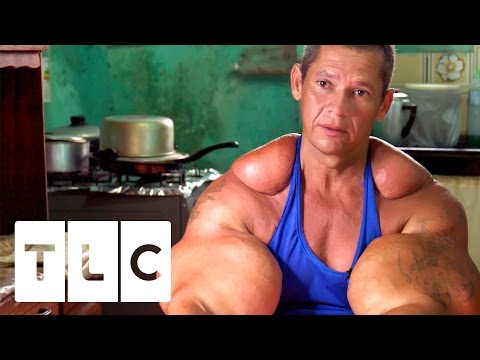 Bodybuilders Inject Muscles With Oil | Real Life Hulks