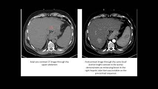 Contrast agents in radiology - RSCP Video Curriculum