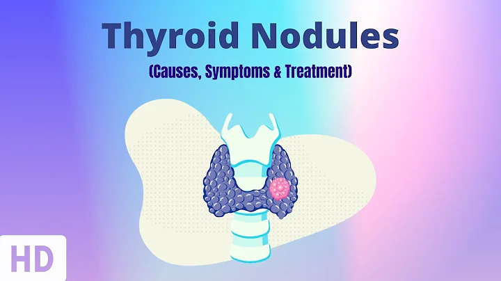 Thyroid Nodules: Causes, Symptoms and Treatment - DayDayNews