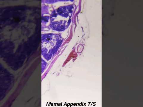 Appendix under microscope
