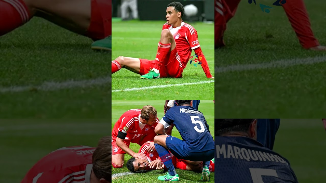 Jamal Musiala Broken Leg After A Collision With Goalkeeper Gianluigi Donnarumma
