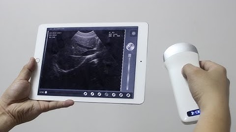 wireless ultrasound probe transducer for ipad, android tablet, computer, vscan pocket ultrasound