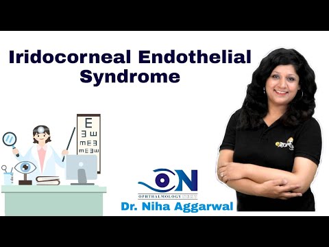 Iridocorneal Endothelial Syndrome || Dr. Niha Aggarwal