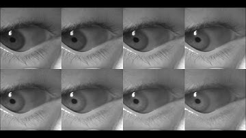 Multispectral Imaging of Eye with Multispectral Camera with 8 Bands NIR