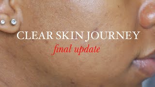 CLEAR SKIN JOURNEY I VITAMINS FOR 30 DAYS FOR CLEAR SKIN I WEEK 3 &amp; 4 UPDATE (WITH PICTURES)