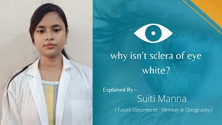 Why Isnt Sclera Of Eye White? By Future Optometrist Suiti Manna Member At Optography