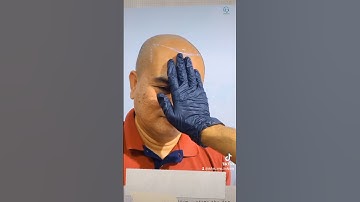 #dubai #hairloss #smp #scalpmicropigmentation #bald #beauty #permanentmakeup #alopecia #bulgaria