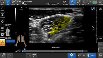 Venue Family | cNerve