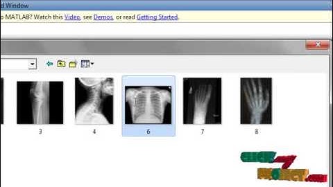 Final Year Projects | Region Based Adaptive Contrast Enhancement of Medical X-Ray Images
