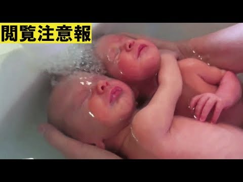 感動 おなかの中にいるみたい 抱き合う双子の赤ちゃん 神秘的な姿 Youtube
