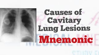 Causes of Cavitary Lung Lesions | Mnemonic "CAVITARY" for all causes of lung cavities | MedSurvival screenshot 4