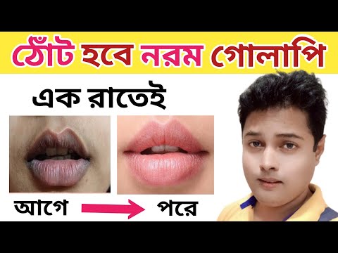 ঠোঁট হবে নরম তুলতুলে গোলাপি এক রাতেই  - ঠোঁট হবে নরম তুলতুলে গোলাপি এক রাতেই 