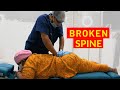 Huge relief from spondylolisthesis  broken spine chiropractic treatment asmr  dr sanjay sarkar