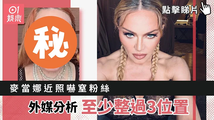 麥當娜近照嚇窒粉絲：到底發生過什麼事？外媒分析至少整過3位置｜01娛樂｜Madonna｜麥當娜 - 天天要聞