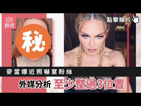 麥當娜近照嚇窒粉絲：到底發生過什麼事？外媒分析至少整過3位置｜01娛樂｜Madonna｜麥當娜