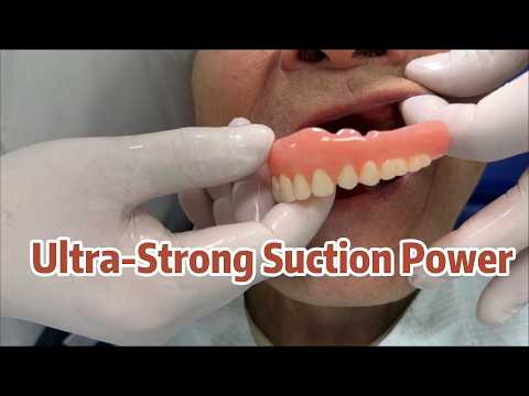 UNBELIEVABLE SUCTION! 😱 No More Loose Dentures (Watch Till The End)#SuctionDentures#SEMCD