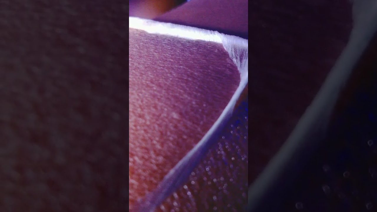 MY THIGH SKIN IS CHSNGING SKIN shorts YouTube