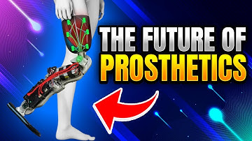 The Future of Prosthetics - 3D Printed Limbs