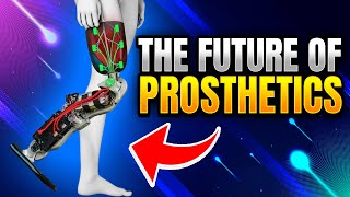 The Future of Prosthetics - 3D Printed Limbs
