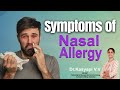 Hi9  symptoms of nasal allergy  dr kasyapi vv ms ent consultant allergy specialist