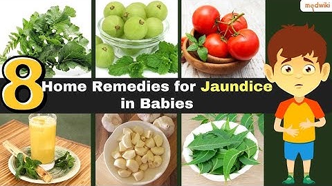 8 Home Remedies for Jaundice in Babies!