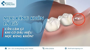Mọc răng khôn là gì? | Cần làm gì khi có dấu hiệu mọc răng khôn?