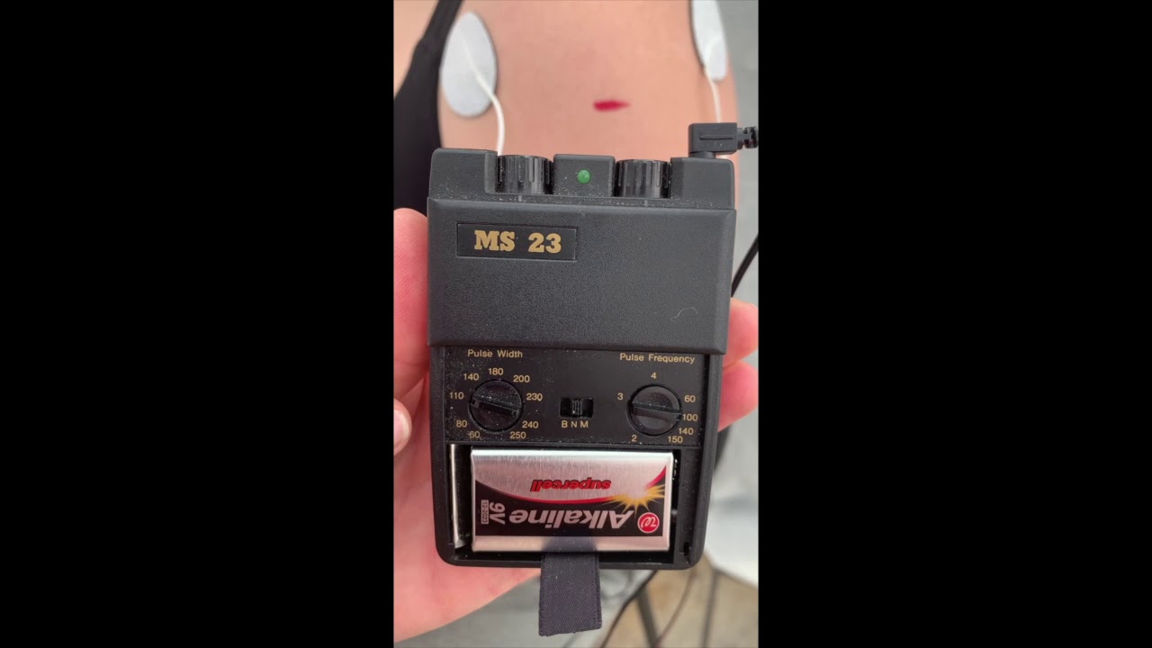 Conventional/ High Rate TENS Demo