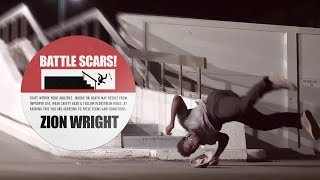 Zion Wright Tells Us About The Worst Injuries Of His Career | Battle Scars