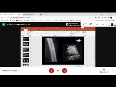 Video Chẩn Đoán Hình Ảnh - Cơ Xương Khớp- Phần 1(1/3) - youtube