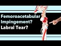 What Is Causing Your Hip Pain, Femoroacetabular Impingement, Labral Tear, How to tell