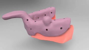 Closed Tray Impression - K3Pro Rapid