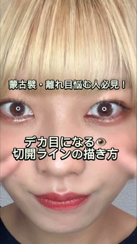 尖った蒙古襞と丸い蒙古襞の目頭切開のやり方 そわんわん Youtube