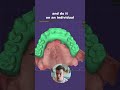 exocad Single Arch bite Adjustment