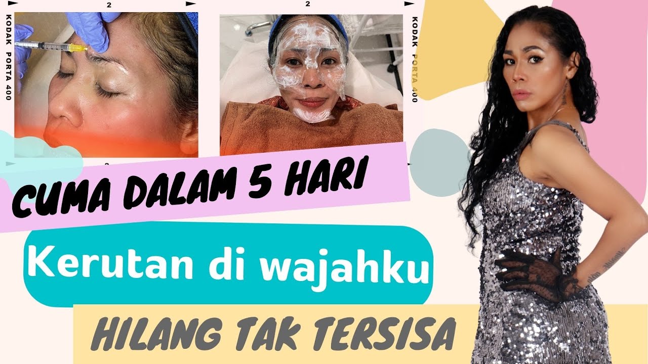 Ngilangin Kerutan di Wajah Hanya Dalam 5 Hari
