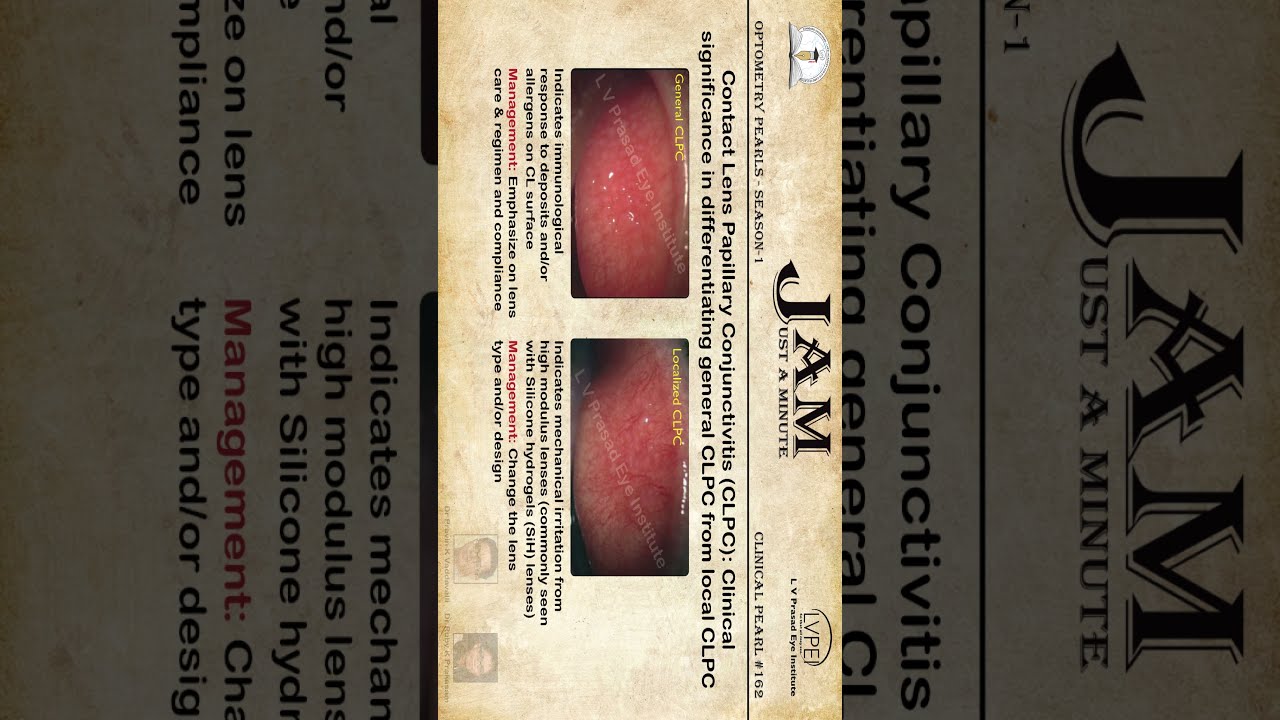 Clinical Significance In Differentiating General Vs Local CLPC
