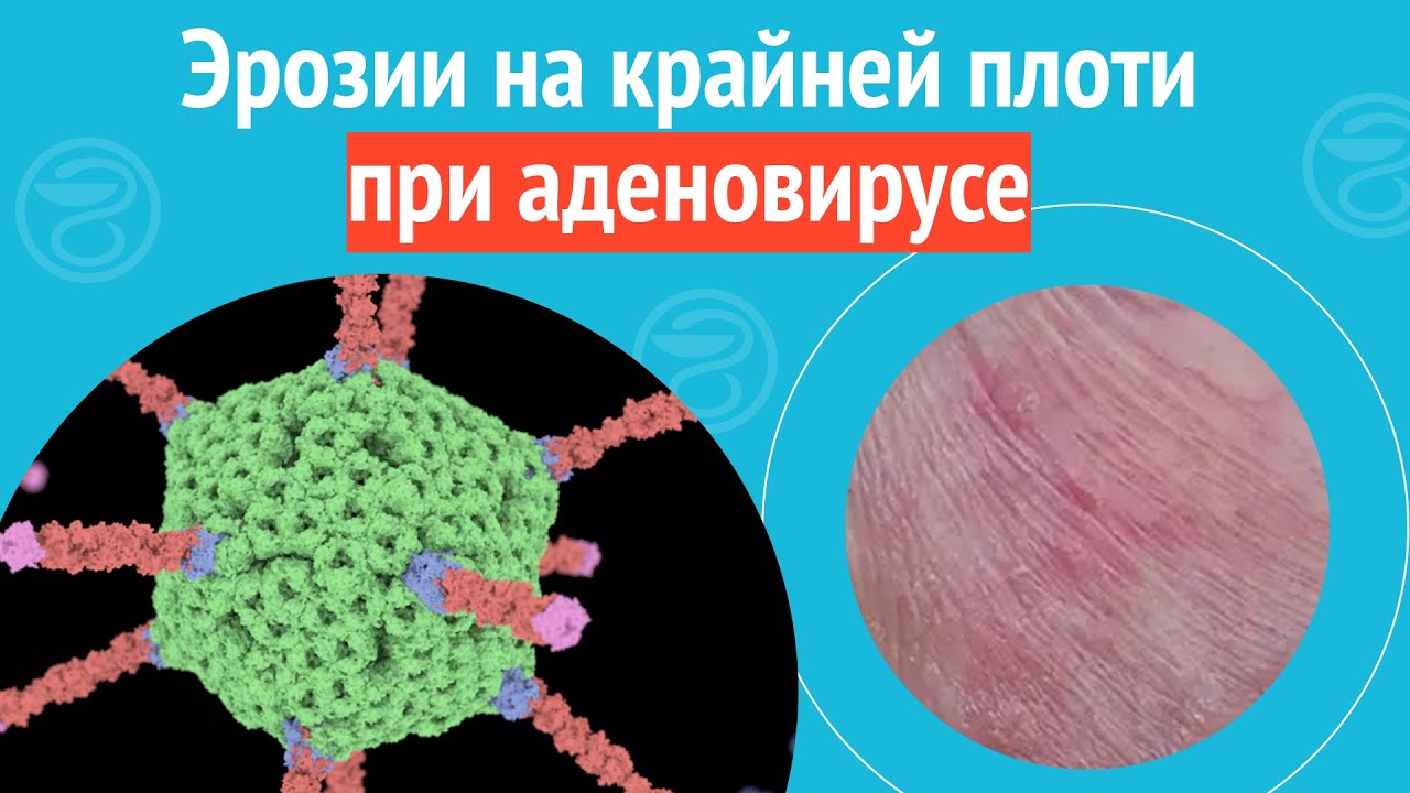 Покраснения Головки У Мужчин Сразу После Секса